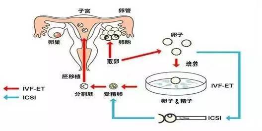 一般着床出血的量是多少ml 一般着床出血的量是多少